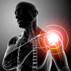 Symptome einer Arthrose